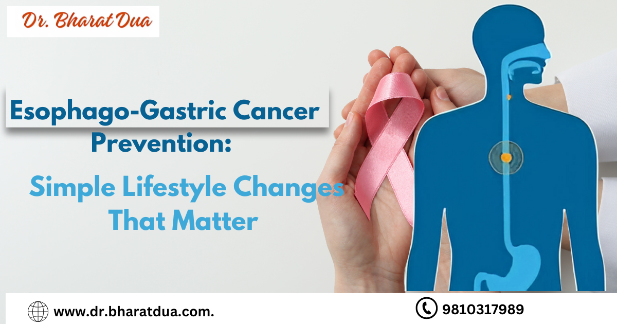 Esophago-Gastric Cancer Prevention: Simple Lifestyle Changes That Matter